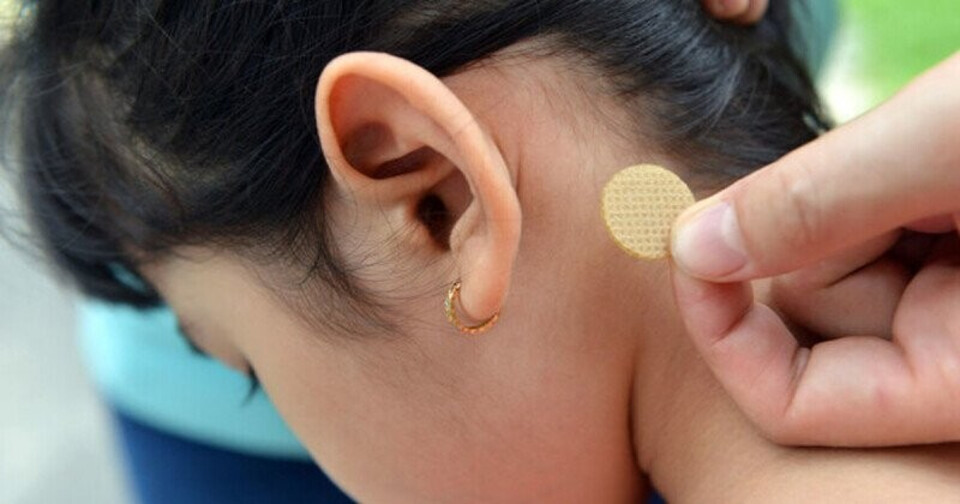 Dùng miếng dán giảm cảm giác say xe Dùng miếng dán giảm cảm giác say xe